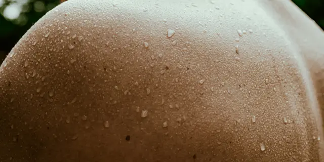 Close-up van huid relevant voor huidtherapeutische behandeling en wondzorg